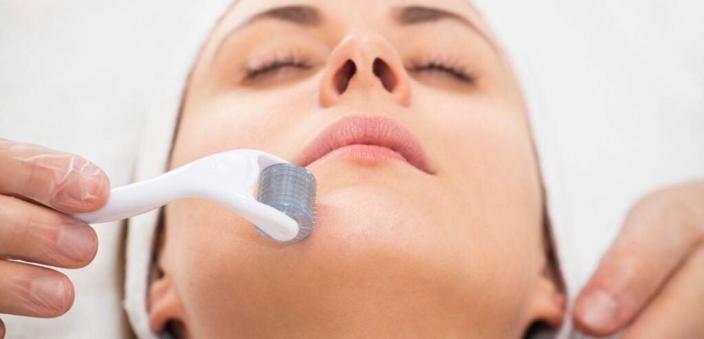 Understanding the Differences Between VIVACE® RF and Rejuvapen® Microneedling