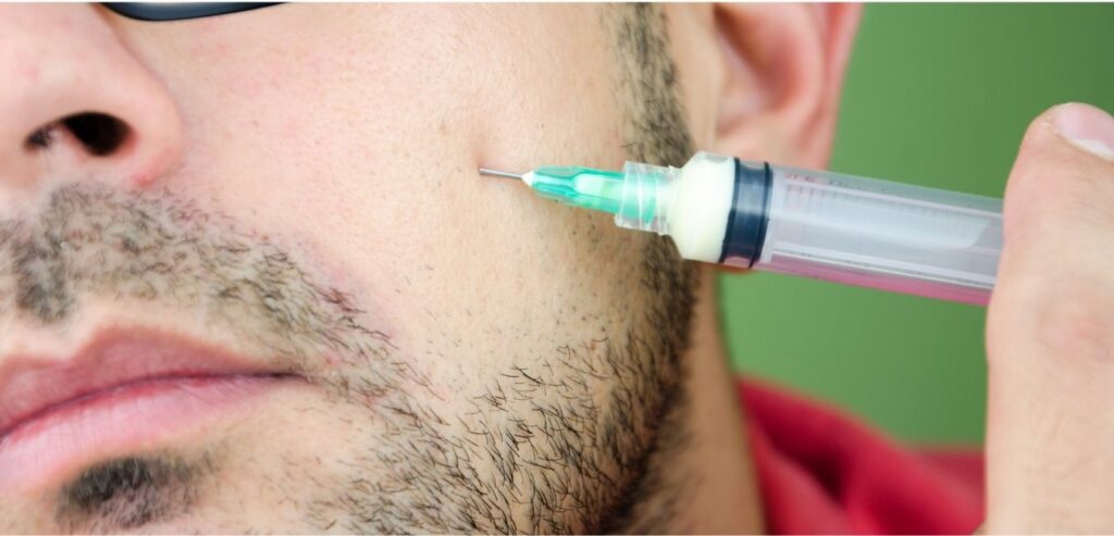 Botox® for Men: Why This is a Growing Trend