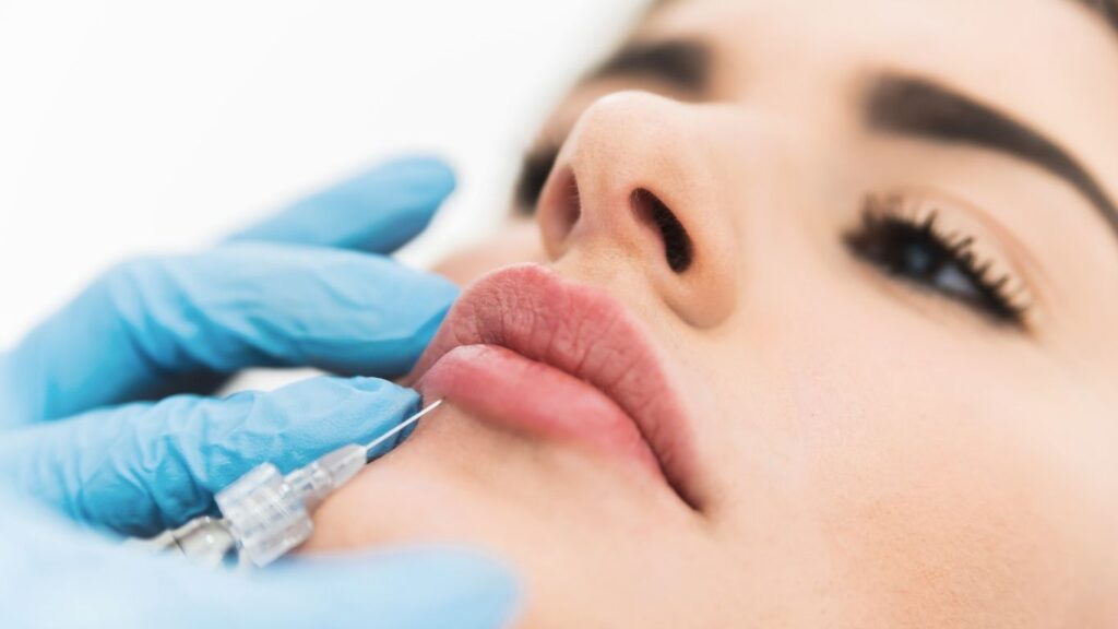 10 Tips for a Great Dermal Filler Appointment