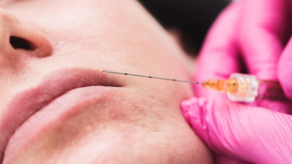 7 Signs You May Have Experienced a Botched Dermal Filler Treatment