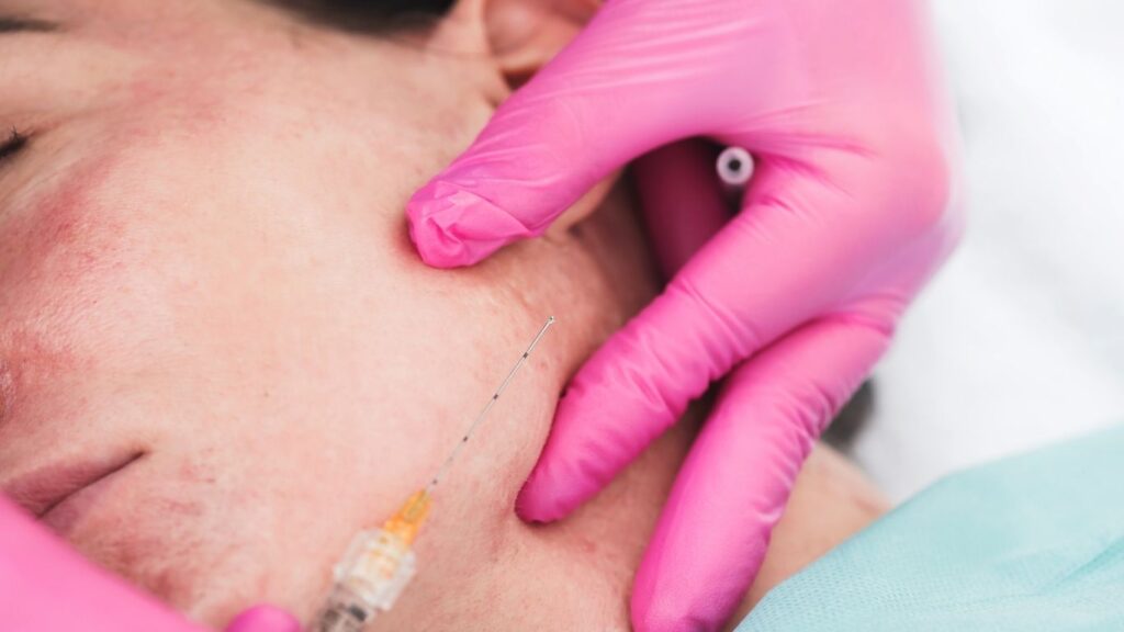 Important Dermal Filler Aftercare Steps You Need to Follow