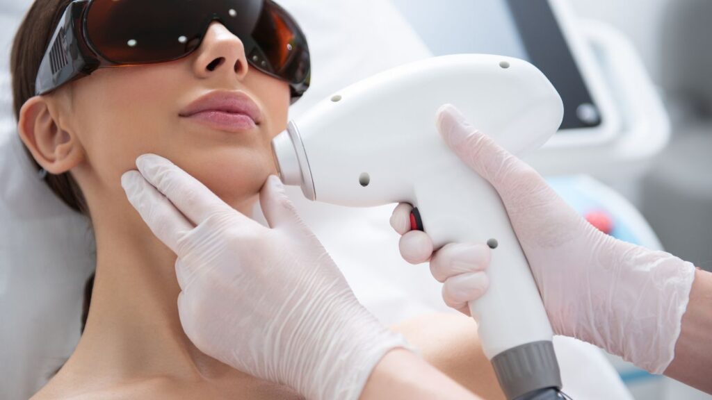 What It’s Like to Get Laser Hair Removal on Your Face