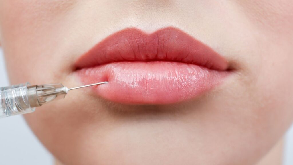 What You Can Expect During an Appointment for Dermal Fillers for Lips