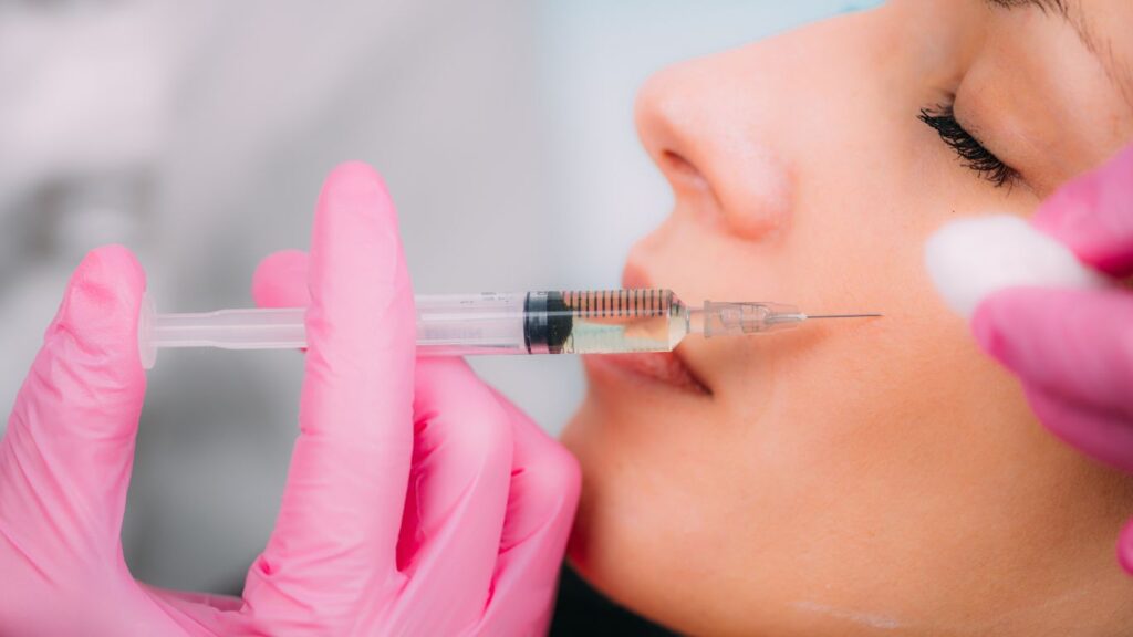 What are Dermal Fillers for Cheek Augmentation?