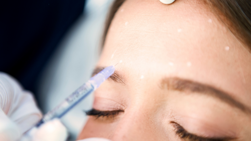 How Does Botox Work?