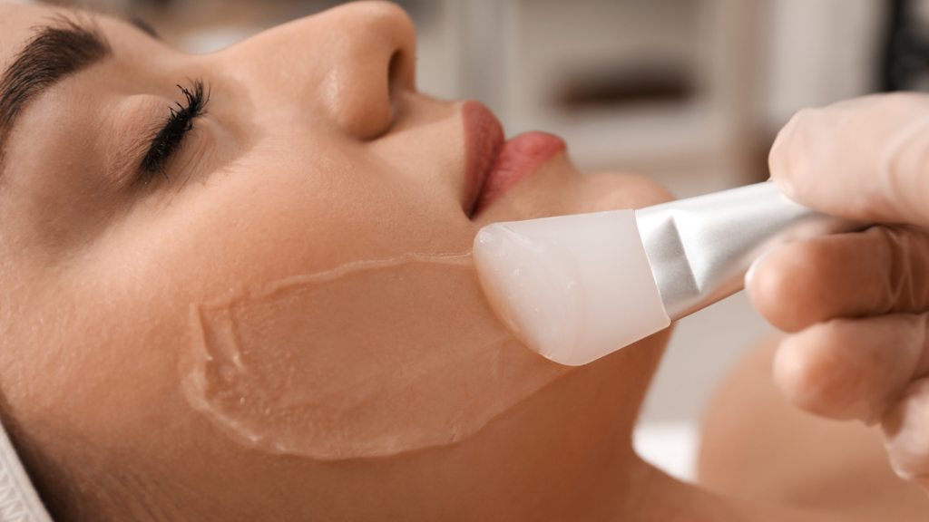 The Difference Between PRX Biostimulation and Traditional Chemical Peels