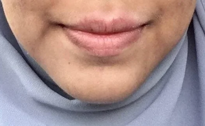 smiling women with undefined lip border