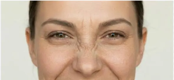 women smiling with bunny lines