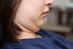 close up view of double chin