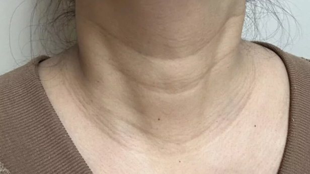 neck bands