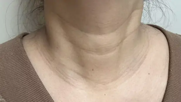 close up view neck bands