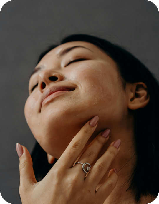 women posing after xeomin treatment in san diego