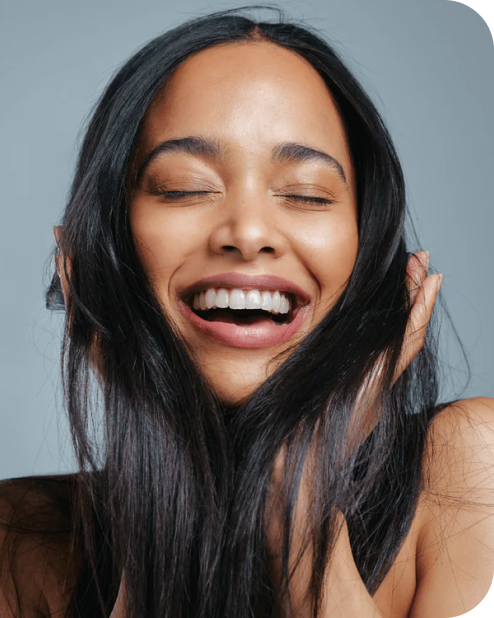 vivace rf microneedeling treatment at the laser cafe