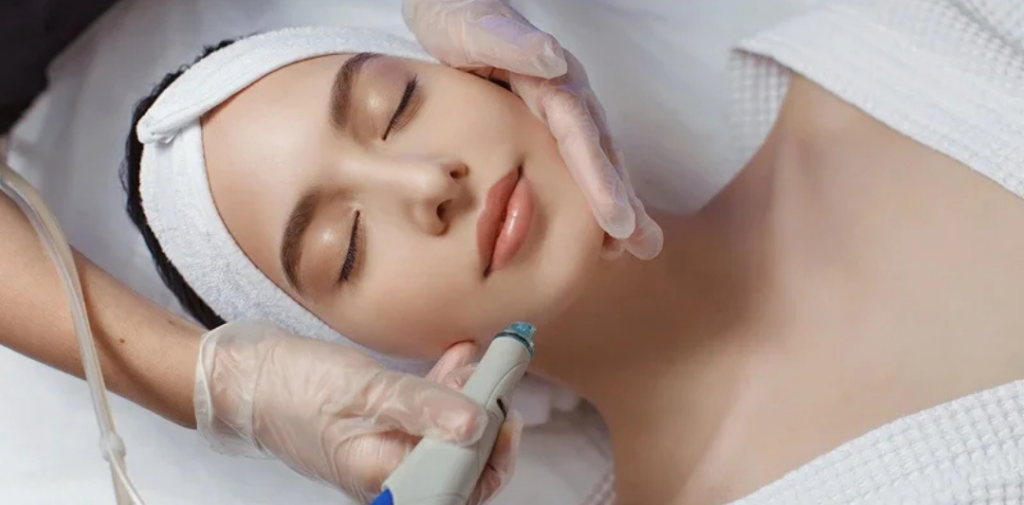 women receiving vivace rf microneedling treatment