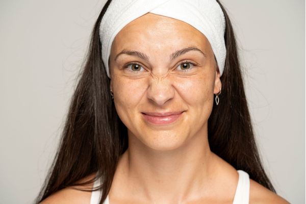 fine lines appearing around the nose when smiling