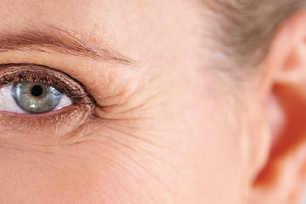 visible crow's feet and fine lines around the eyes