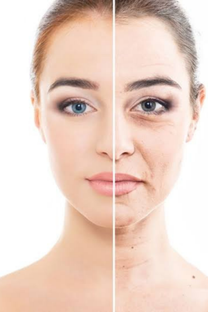 daxxify before and after comparison showing reduced facial wrinkles and smoother skin