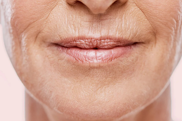 Close-up of mature skin around the mouth showing fine lines and wrinkles