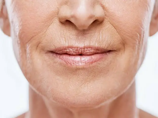 fine lines around mouth