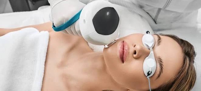 ongoing ipl photofacial treatment in san diego