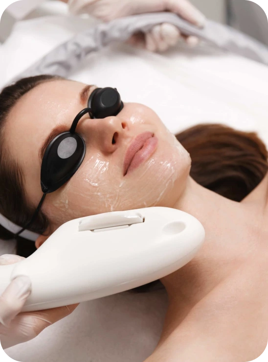 ipl photofacial treatment in studio med spa