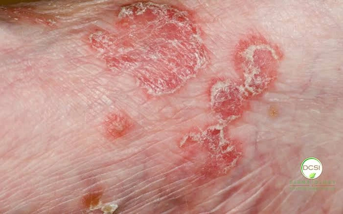 vascular issues